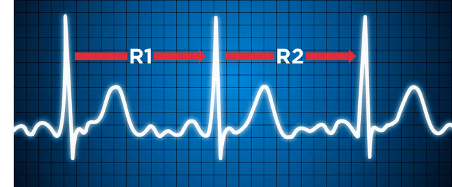 Herzfrequenzvariabilität (HRV)